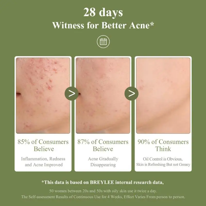 

Purifying Acne removing gel Whitening Moisturizer Skin Care Repair Facial Scrub Cleaner Acne Blackhead Treatment Remove Gel