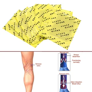 Пластырь для лечения варикозного расширения вен, натуральный раствор васкулита, травяной крем, 9 шт.