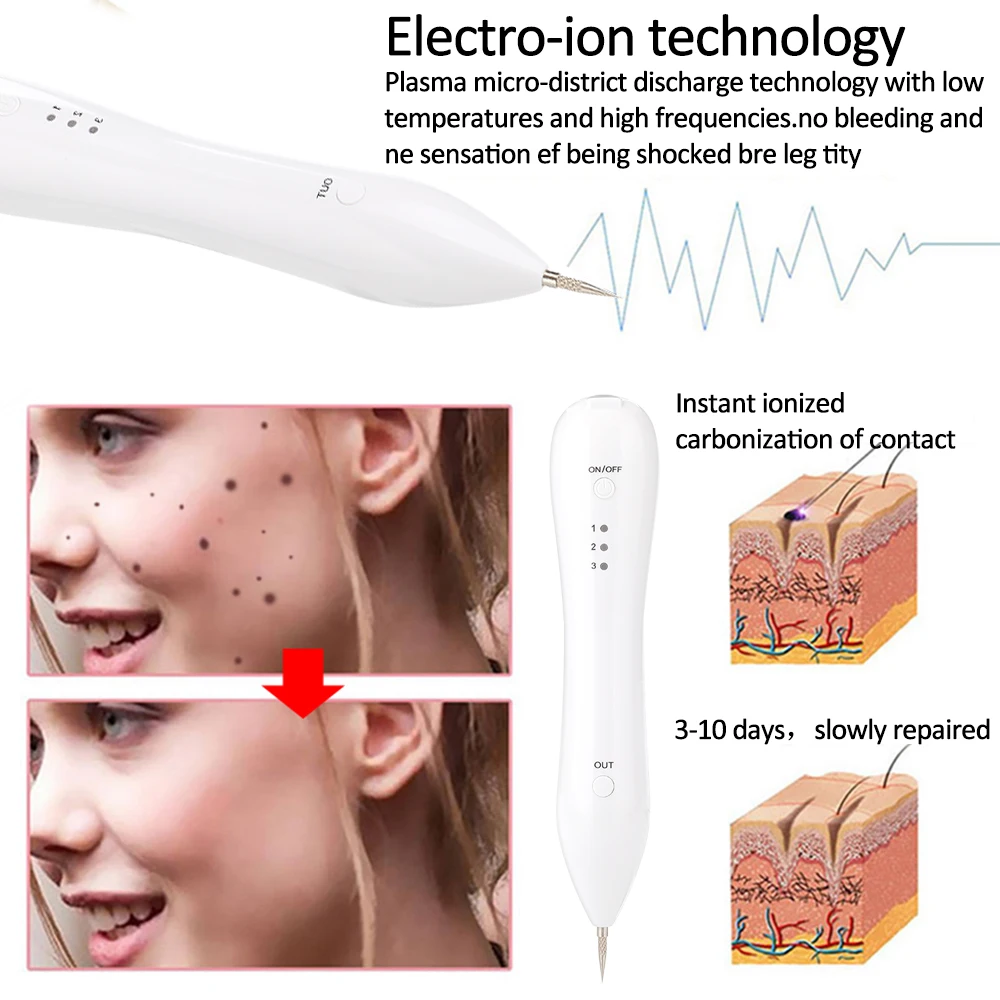 

Tattoo Remaval Pen Dark Spot Remover Laser Freckle Removal Machine Skin Mole Removal for Face Laser Mole Removal Pen Set