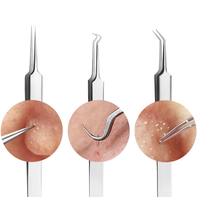 

Acne Clip Needle Cell Clip Acne Removal Needle Acne Squeezing Tool Acne Picking Needle Blackhead Clip Makeup Set Women