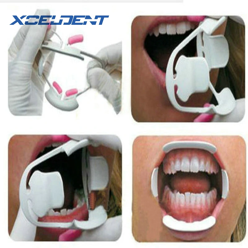 3D ротовая открывалка для полости рта интраоральные щеки губы Ретрактор Prop