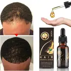 Sevich органическое питательное Восстанавливающее Средство против выпадения кожи головы, масло для роста волос, сыворотка для роста волос, эссенция 20 мл