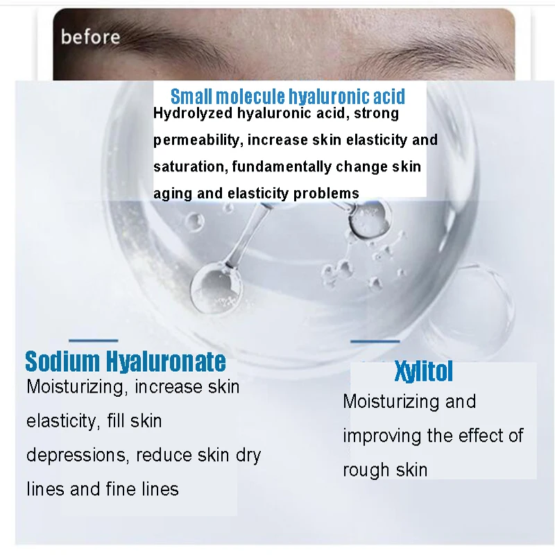 Патчи под глаза с микроиглами и гиалуроновой кислотой 10 пар |