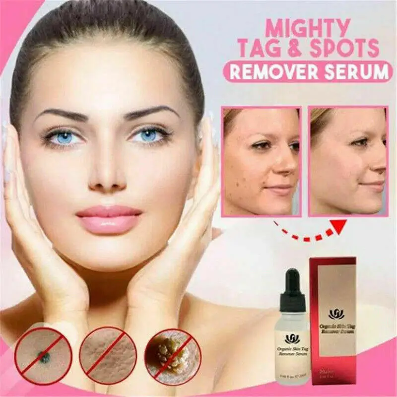 

Organic Skin Spot Purifying Serum Natural Free Mole Tag Removal Facial Skin Care Freckle Repair Cream Painless Odorless