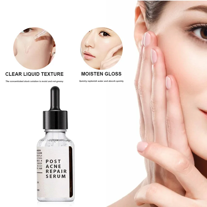 

30ml Salicylic Acid 2% Solution Removes Acne Face serum Shrinks Pore Moisturizing Essence Fade Spot Brighten Face Skin Care