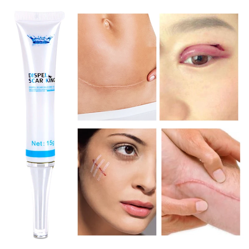 

Skincare Medical Scar Repair Gel CE FDA Approved Scar Removal Dressing Beauty Tool for Surgical Hyperplasia Scars Burn Scald