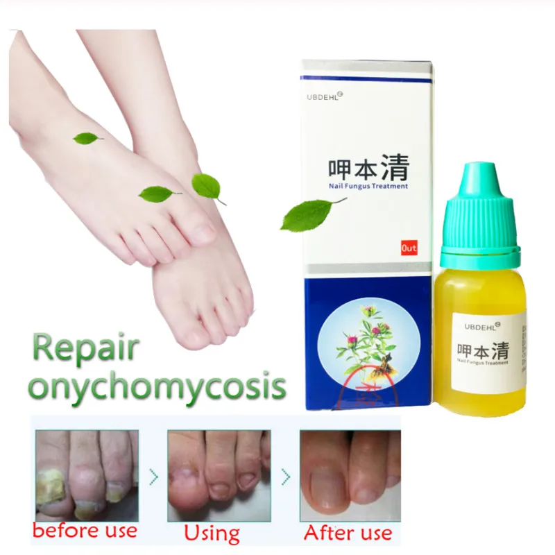 1/2PCS жидкость для лечения онихомикоза паронихии противогрибковые инфекция