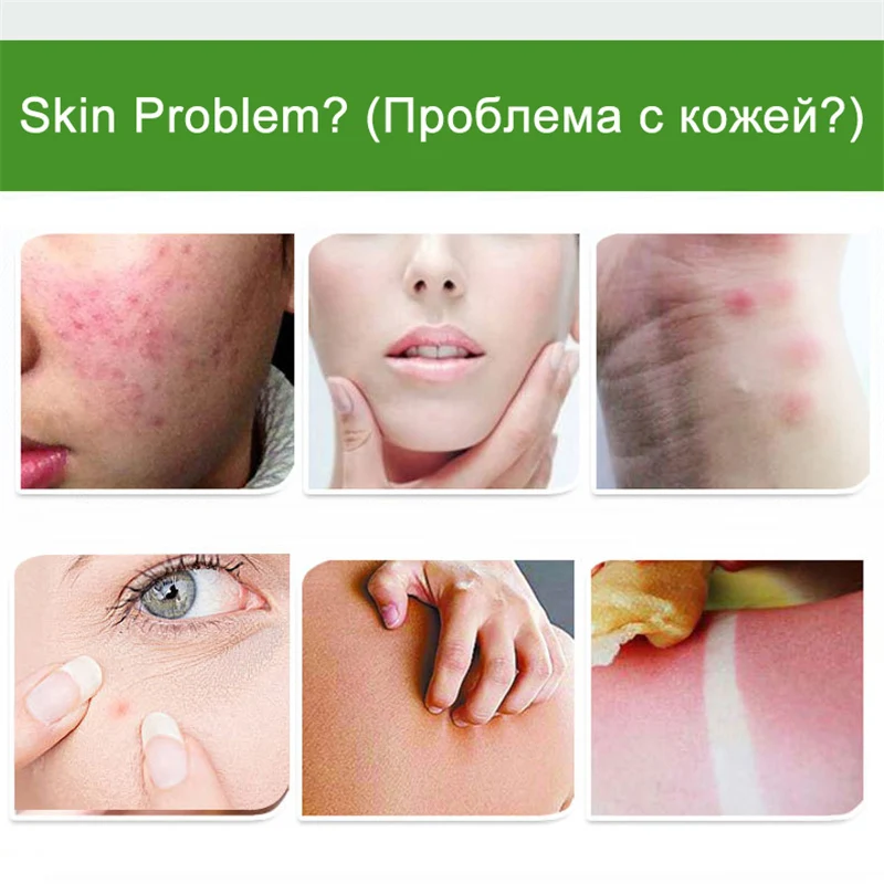 Натуральный разглаживающий гель с алоэ вера уход за кожей лица лечение акне