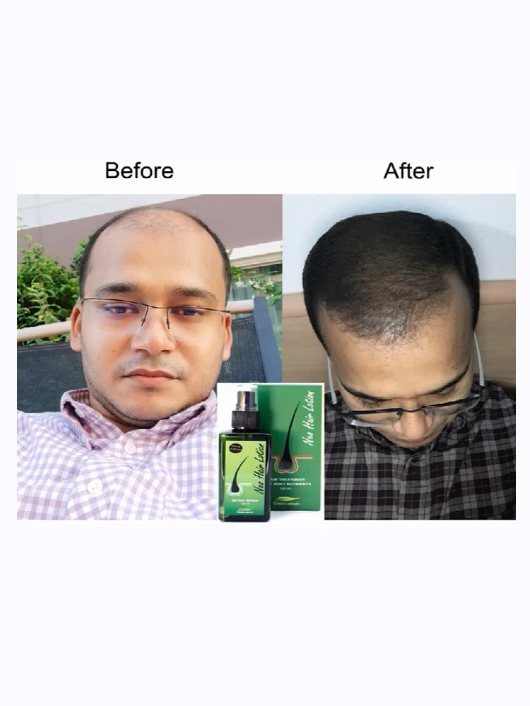 Лосьон для волос с питательными веществами корней 120 мл|Уход за волосами и кожей