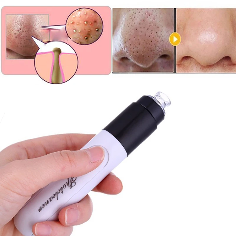 В черный горошек для девочки, вакуум для Acne Электрический инструмент для удаления чёрных точек для чистки лица глубокой очистки пор Красота уход Удаление прыщей инструмент