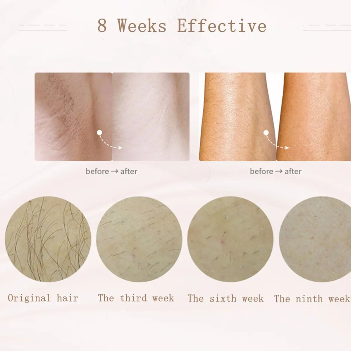 

Hair Removal 500000 flashes