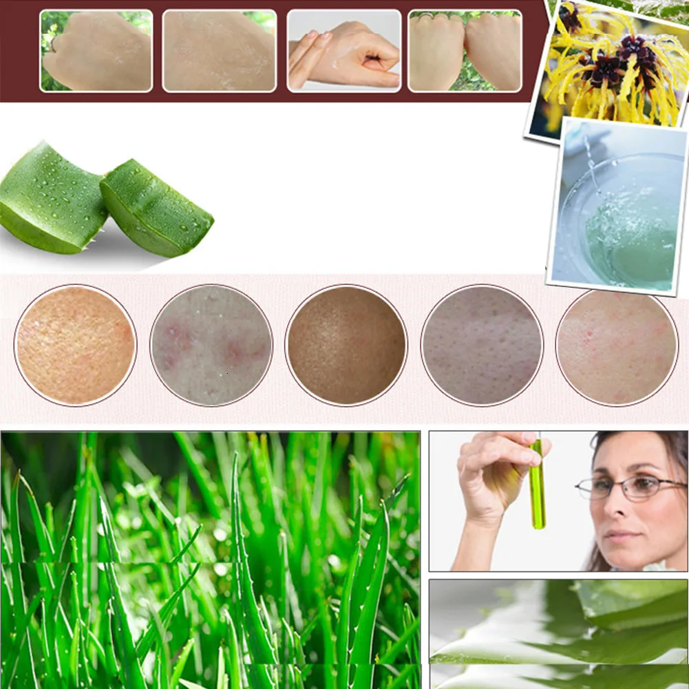 Чистый Натуральный гель против морщин с алоэ вера удаление Увлажняющий анти акне