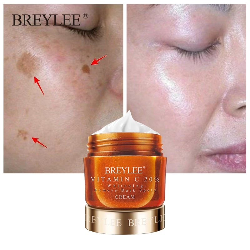 

2PCS Vitamin C 20% Vc Whitening Facial Cream Remove Fade Freckles Remover Dark Spots Brightening Cream Face Skin Care 30g