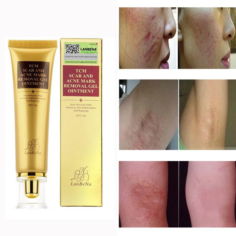 

Acne Scar Removal Cream Acne Treatment Face Pimples Stretch