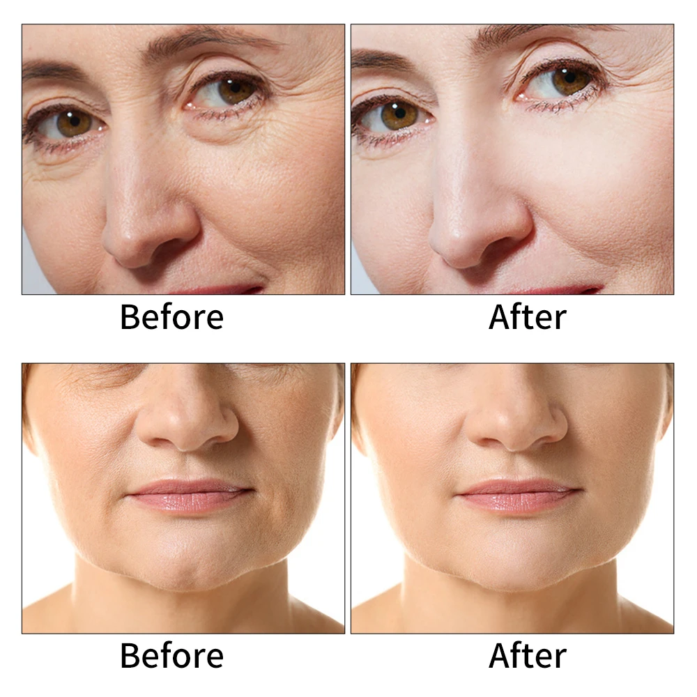 EMS массажер для лица RF радиочастотная машина ультразвуковой повышает упругость