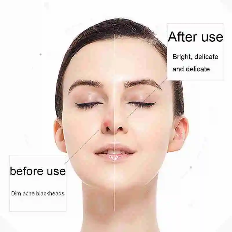 

Blackhead Electric Beauty Device Household Guasha Cupping Removing Cleansing Care Pore Smart Skin Pores Suction S1W5