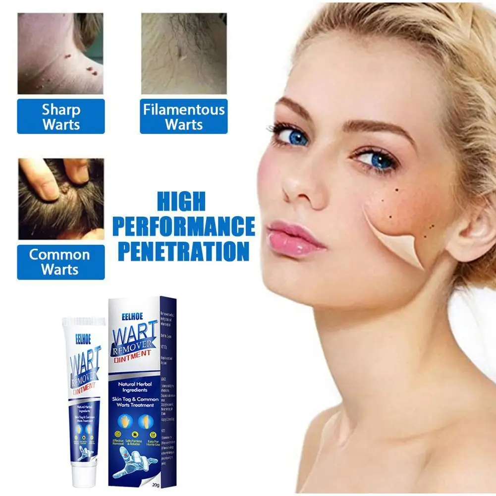

New 1 Pcs 20g Wart Cream Repairs Cleans The Skin Usually Body Face Treatment Care Cream Skin Tag Remover Wart Cream