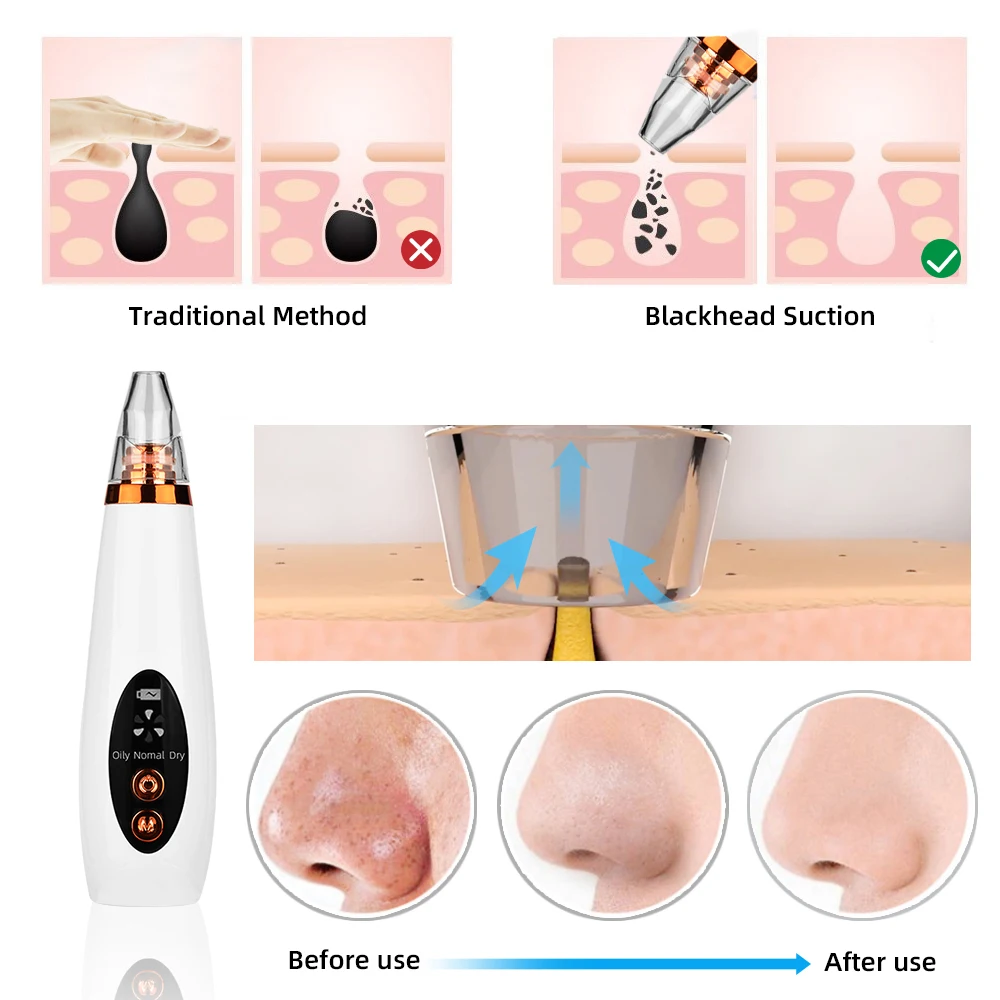 Электрический прибор для удаления черных точек устройство ухода за кожей лица