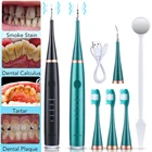 Электрический ультразвуковой прибор для чистки зубов