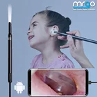 Миниатюрный ушной эндоскоп, камера для чистки, Бороскоп, отоскоп, Мобильный для смартфона, эндоскоп для автомобилей, мобильный зонд, микро-эндоскоп Usb C