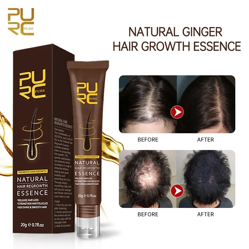

PURC Hair Growth Oil Natural Thickener Essence Anti Hair Loss Care Products Fast Hair Growth Scalp Massage Roller Treatments Oil