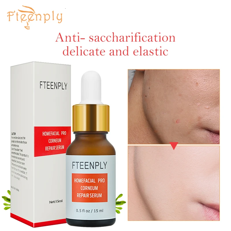 Homefacial PRO Сыворотка для лица с гиалуроновой кислотой FTEENPLY, увлажняющая, отбеливающая, против старения, от морщин, восстанавливающая от солнечных ожогов, подтягивающая, укрепляющая, для ухода за кожей - Вес нетто: Homefacial PRO