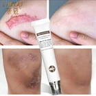 Средство для удаления растяжек LAIKOU, уход за кожей, крем для шрамов от растяжек, лечение шрамов, Восстанавливающий уход за кожей, крем для тела, био-масло