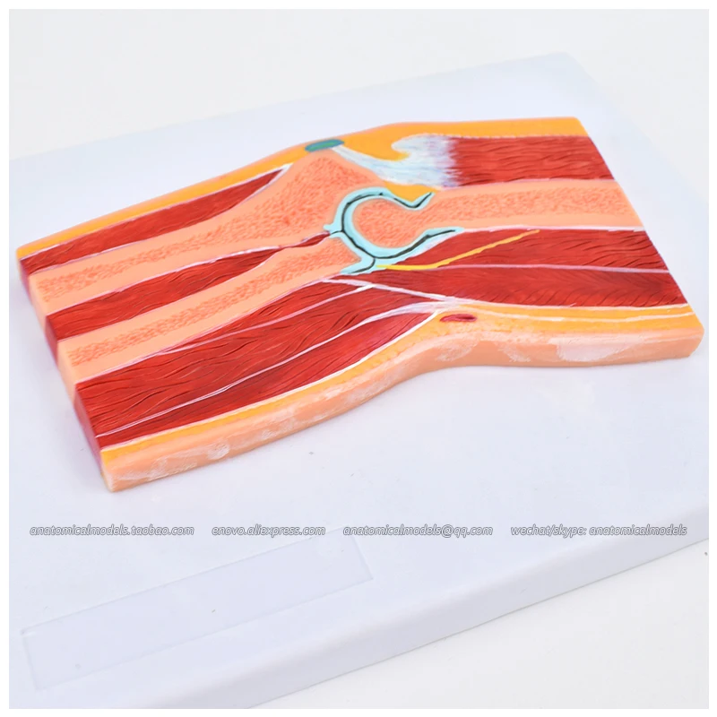 

12712/ Elbow Joint Section, Medical Science Didactic Joint and Extremities Model
