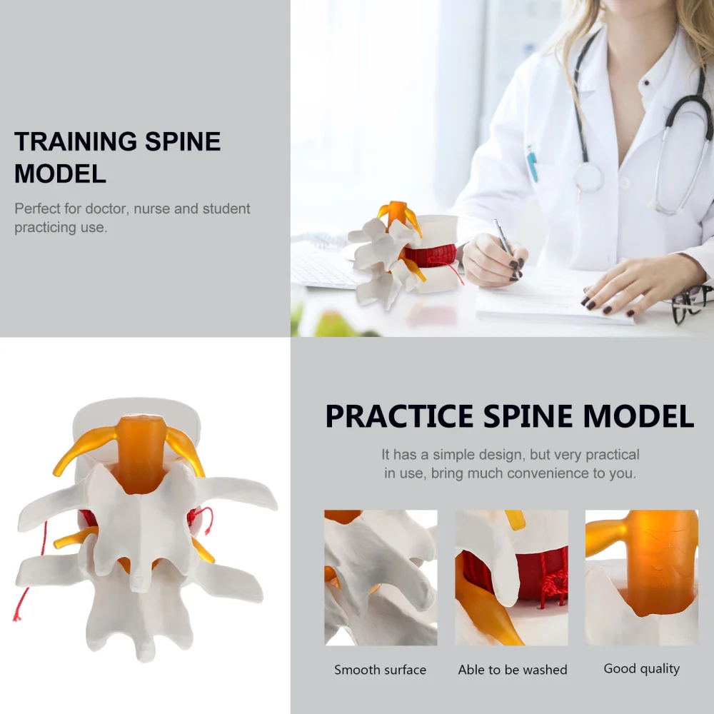 

1Pc Human Spine Model Lumbar Disc Herniation Presentation Model for School