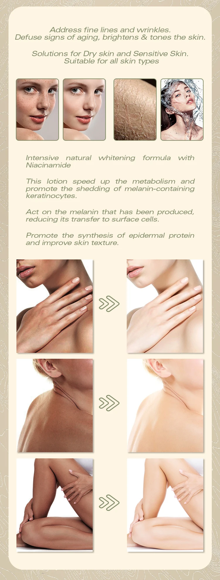 Лучший отбеливающий крем для подмышек Женский черной темной кожи лосьон тела