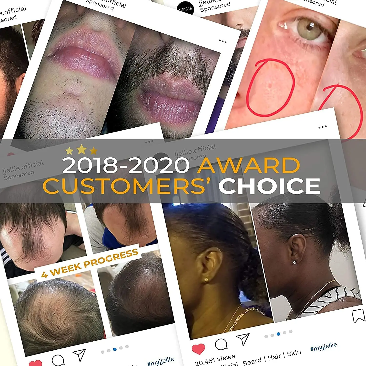 Микро игла 540 ролик Дерма Дермароллер Титановый рост волоса Борода Рост препараты против выпадения Обработка тонировки.