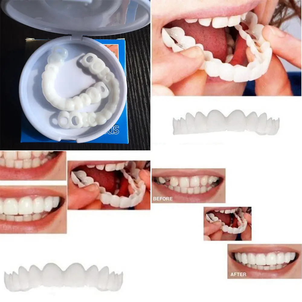 Верхние и нижние виниры накладные зубы нетоксичные практичные пластиковые для