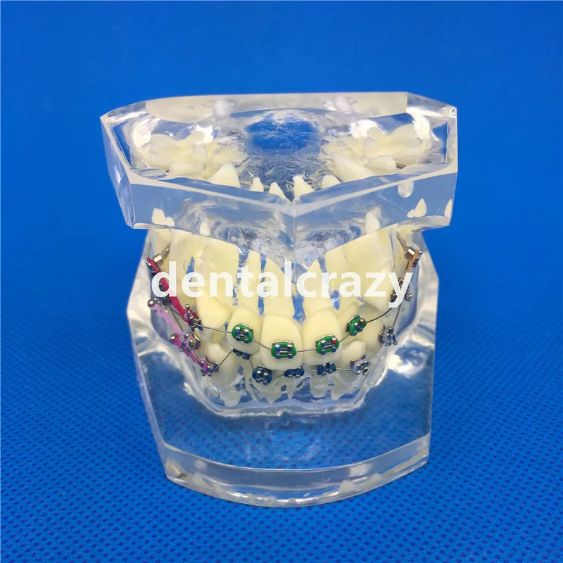 Стоматологическая модель зубов прозрачная ремонта патологического имплантата