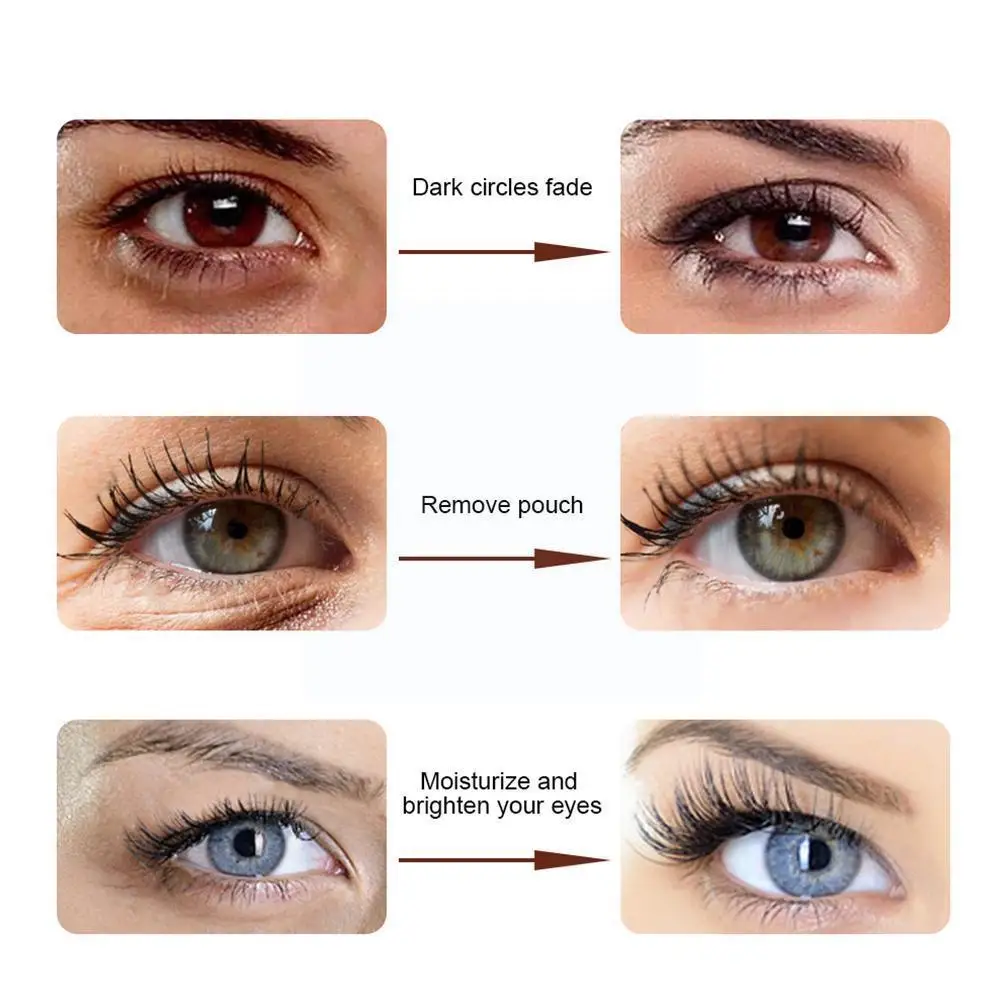 

Snake Eye Cream Anti-aging Eye Cream Remove Dark Fine Eye Lines Moisturizing Puffiness Lighten Circles Care Whitening O9l4