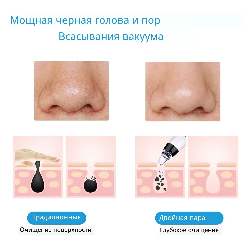 Уход за кожей, вакуумный удалитель черных точек, Удаление прыщей, вакуумный всасывающий инструмент для очистки лица, Алмазная дермабразия для лица
