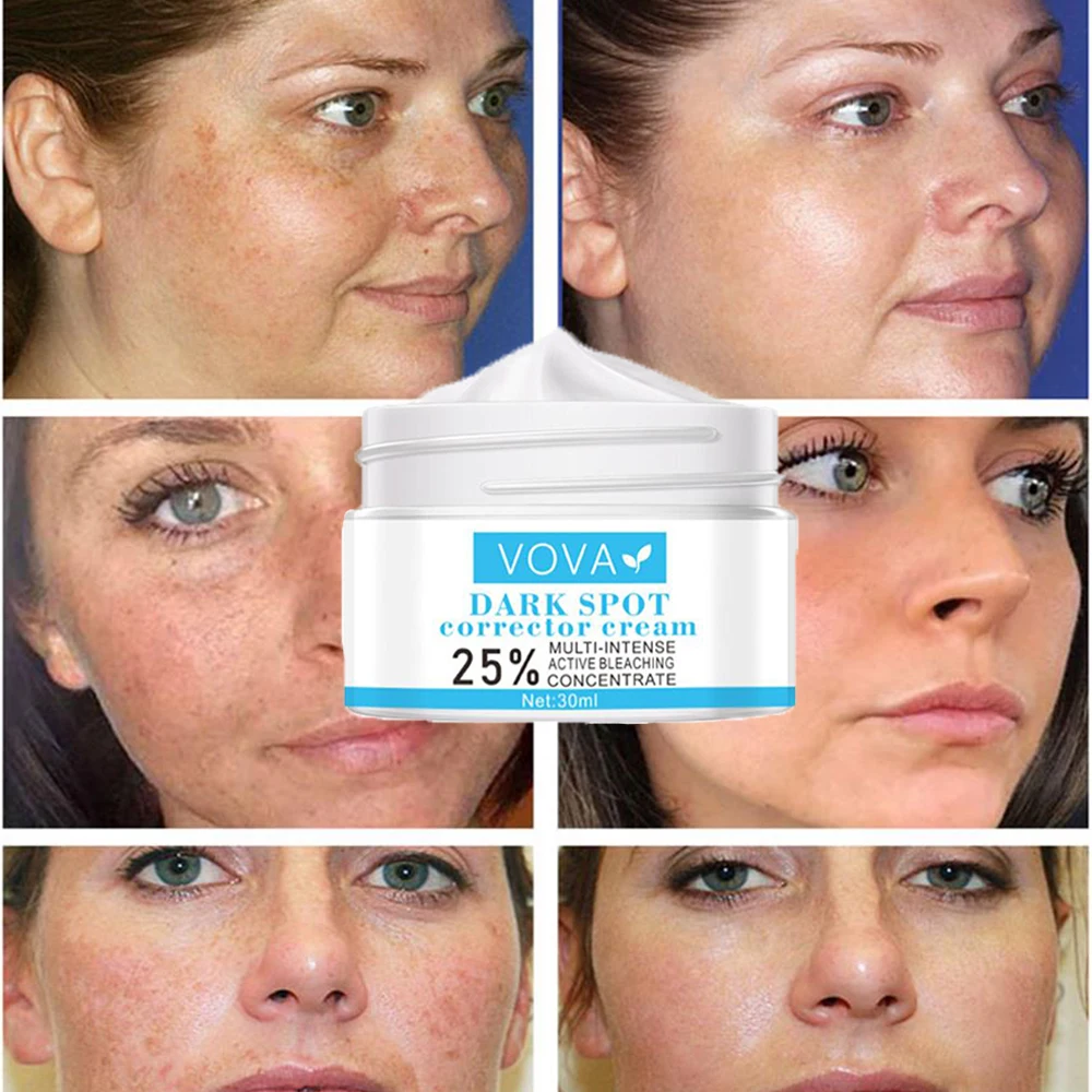 Темное пятно корректирующий крем 25% мульти интенсивный активный отбеливающий