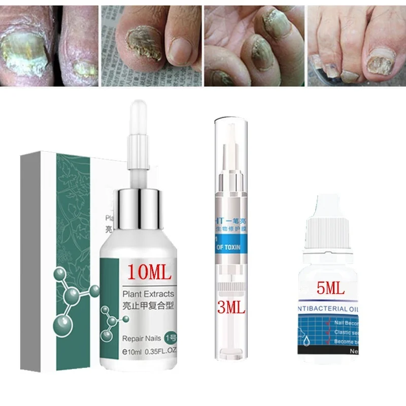 Средство для лечения грибка ногтей 3/5/10 мл средство онихомикоза паронихия