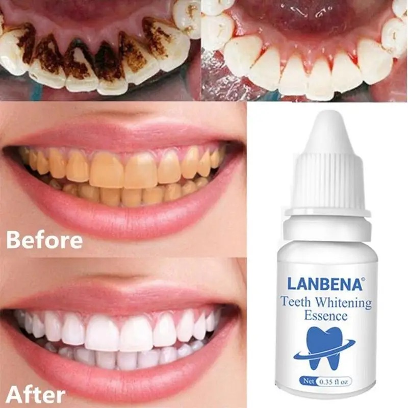 

10ml Liquid Teeth Whitening Oral Hygiene Cleaning Teeth Tooth Removes Stains Bleaching Plaque S8R7
