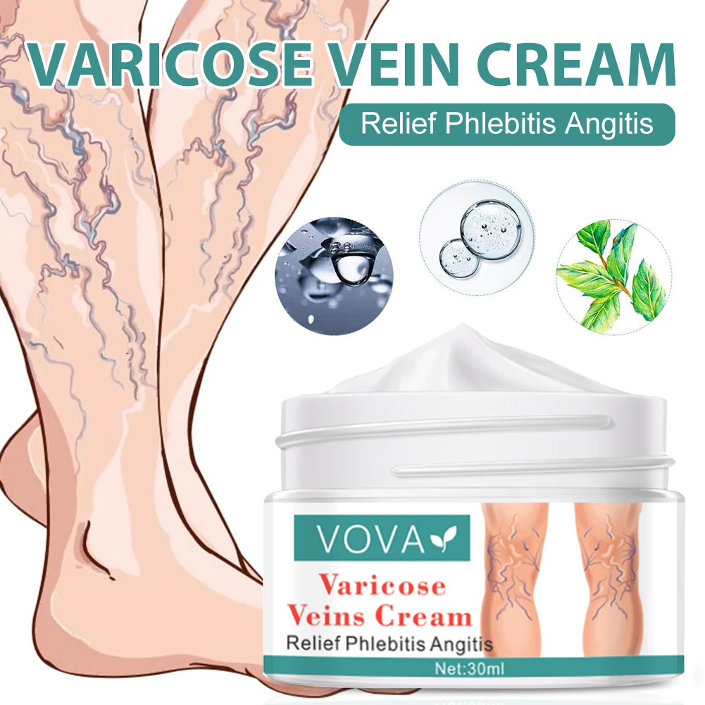 

1PC Varicose Veins Cream Relieves Phlebitis Angiitis Inflammation Blood Veins Spider Veins Treatment Pain Relief Ointments New