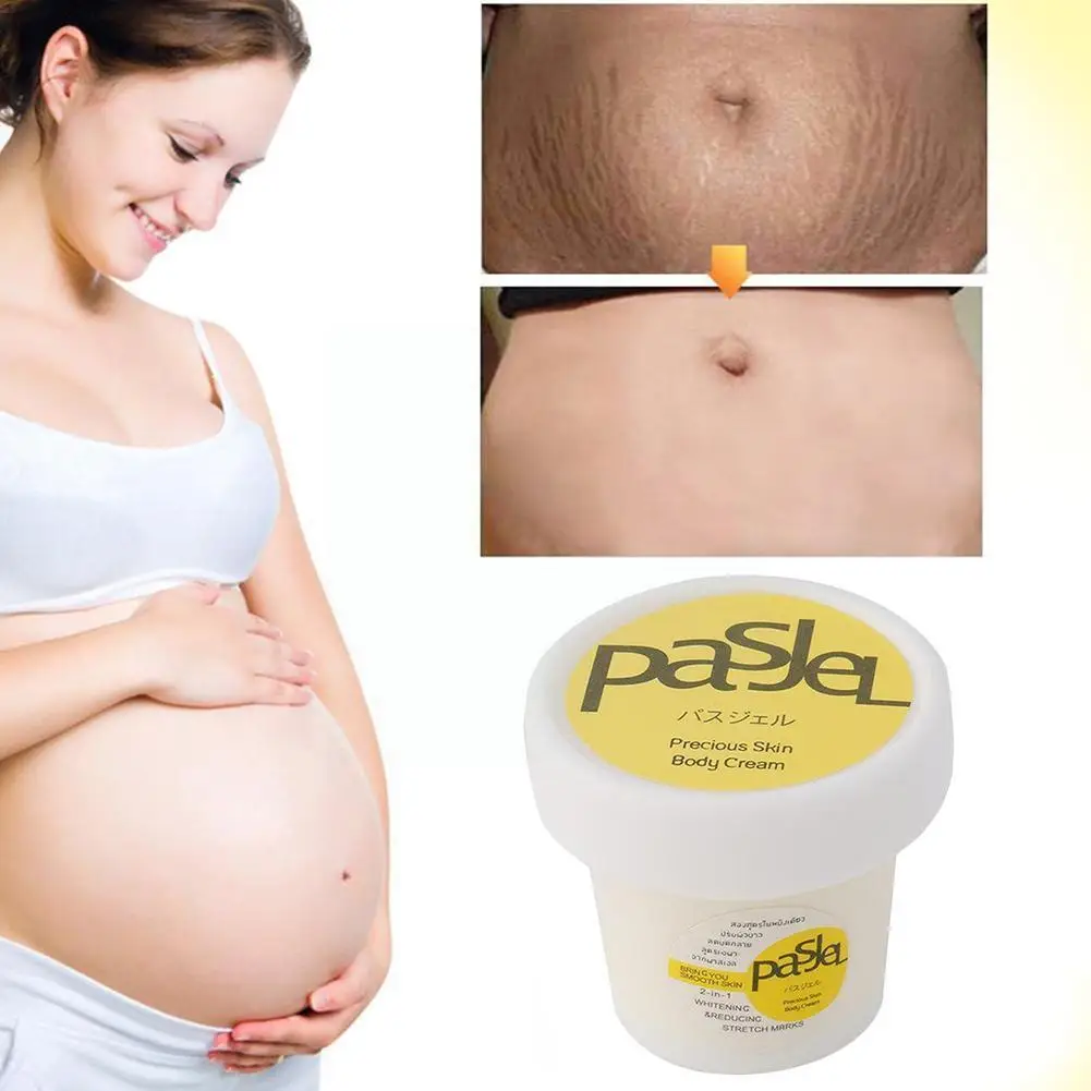 

Pregnancy Repair Cream Smooth Skin Repair Skin Lines Reduce Lines Obesity Repair Postpartum M9a6