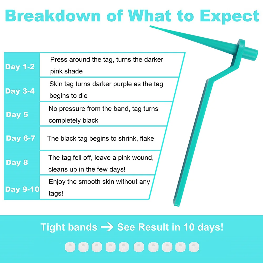 

1set Skin Tag Kill Skin Mole Wart Remover Micro Skin Tag Removal Kit with Cleansing Swabs Adult Mole Wart Face Care