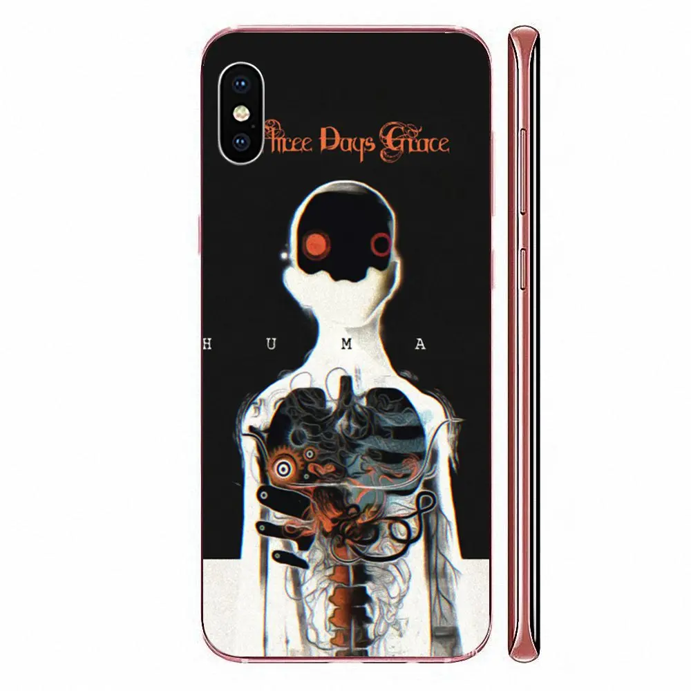 Фото Чехол из мягкого ТПУ Three Days Grace для LG G3 G4 G5 G6 G7 K4 K7 K8 K10 K40 K50 Q6 Q60 V10 V20 V30 V40 Nexus 5 5X 2017 Чехол из мягкого ТПУ Three Days Grace для LG G3 G4 G5 G6 G7 K4 K7 K8 K10 K40 K50 Q6 Q60 V10 V20 V30 V40 Nexus 5 5X 2017