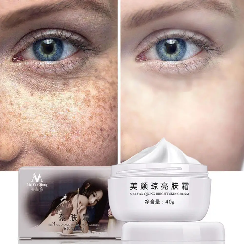 

40g Strong Effects Powerful Whitening Freckle Cream Moisturizing Whitening Acne Melanin Spots Care Melasma Remove Pigment S B3Z4