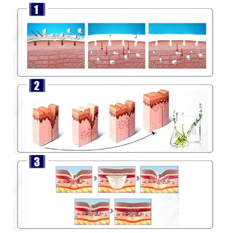 30 г полезный шрам ремонт кожи эфирное масло экстракт лаванды Природный уход за