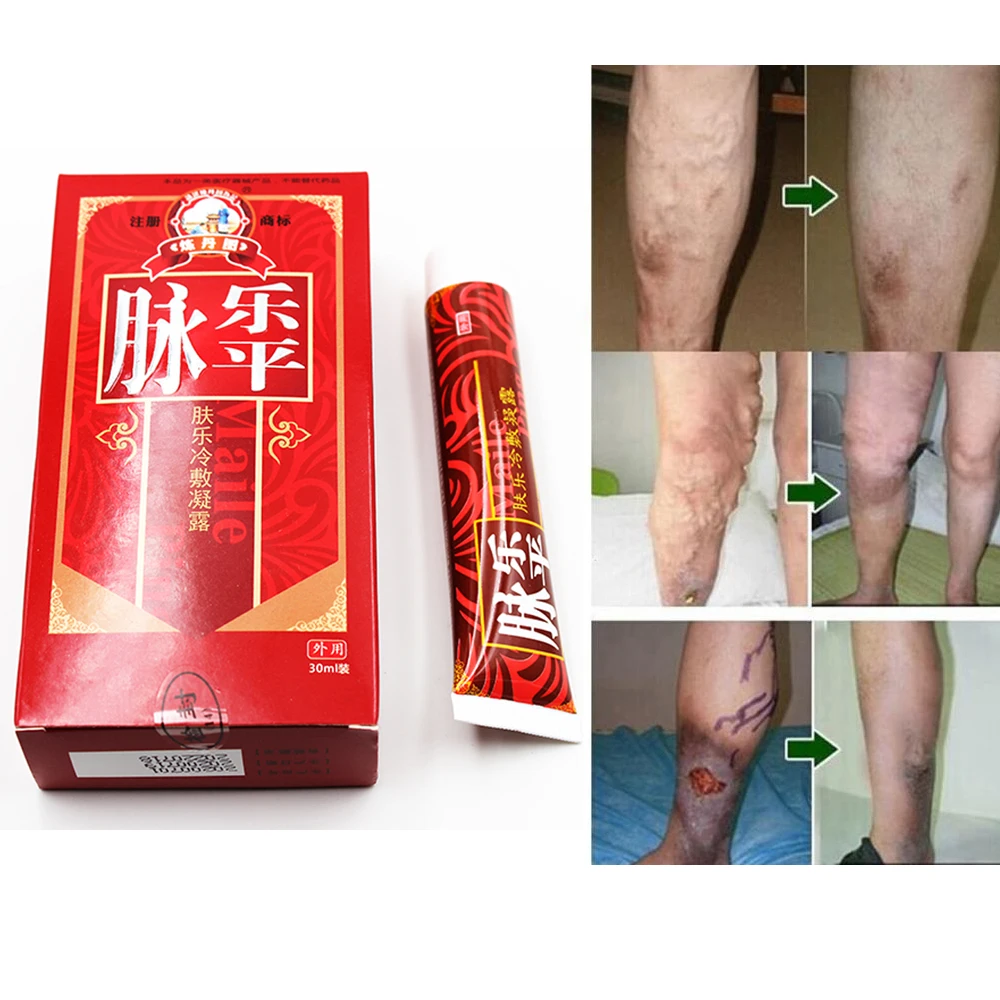 1 шт. паучьи вены варикозное расширение пластырь для лечения варикозного