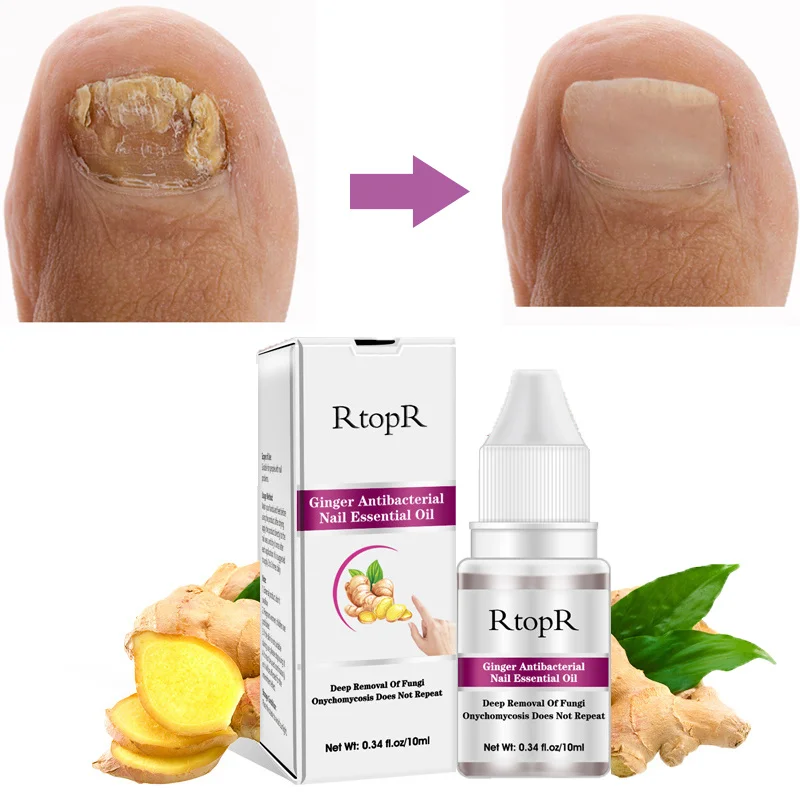 

Fungal Nail Treatment Serum Ginger Onychomycosis Toe Nail Fungus Removal Gel Foot Essence Anti Infection Paronychia Feet Care