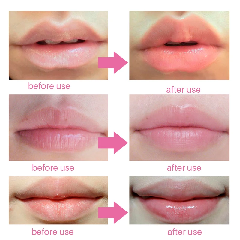 

10Pack Gold Collagen Crystal Lip Mask Hydrating Moisture Essence Gel Masks Patches Lighten Lip Line Lips Enhancer