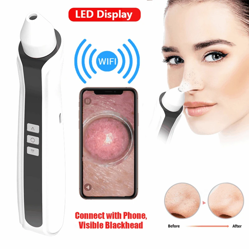 

Electric Visual Blackhead Remover Vacuum with Camera Wifi HD Skin Vacuum Acne Pore Cleaner Face Cleanser Blackheads Remover