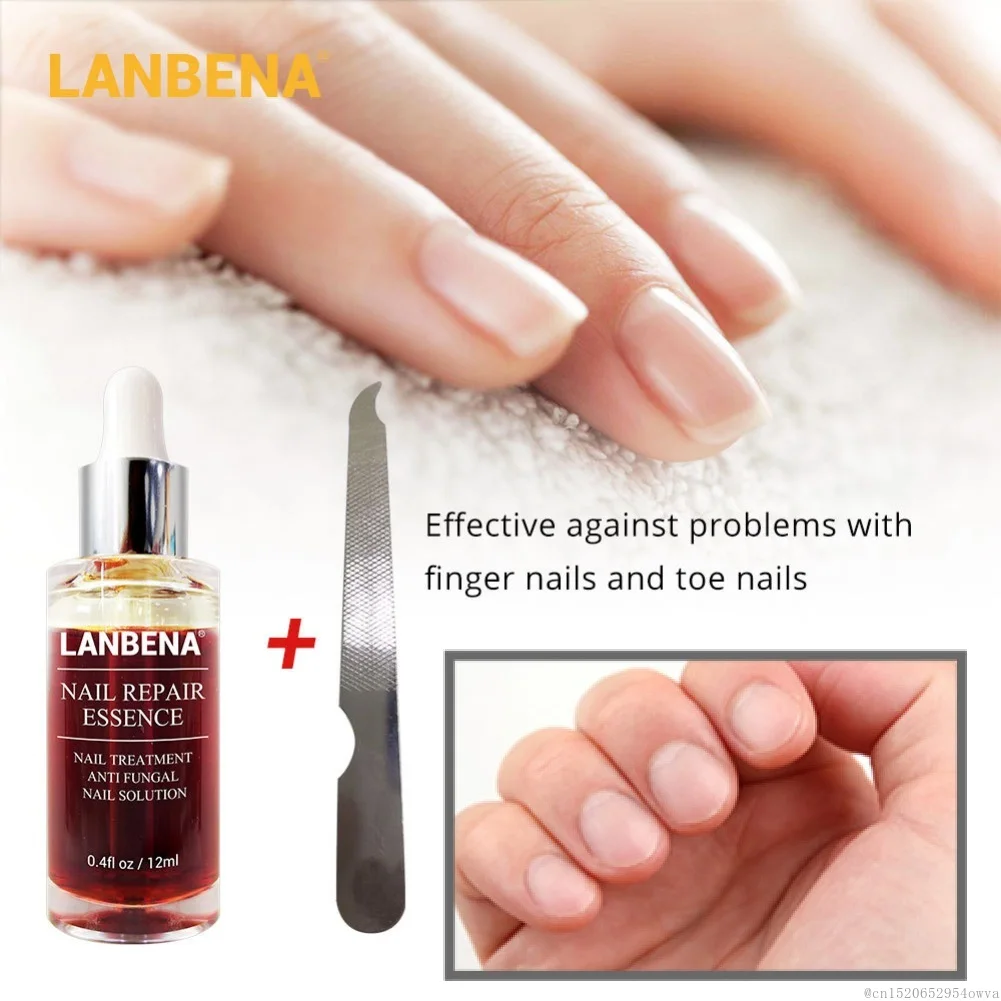 

LANBENA Nail Repair Liquid Treatment Anti Remove Nail Fungus Toe Nourishing Brighten Onychomycosis with File Nail for Gift