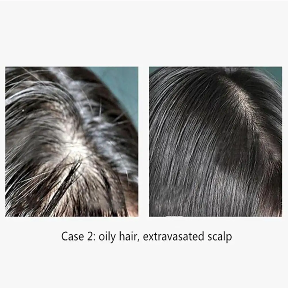 

Hair Darkening Shampoo Handmade Soap Nourishing Hair Oil Control Softening Roots Scalp Soap Essential Care Oil S Hair Clean Z1G5